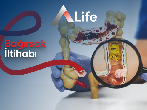 Bağırsak İltihabı: Sağlıklı Bir Sindirim Sistemi